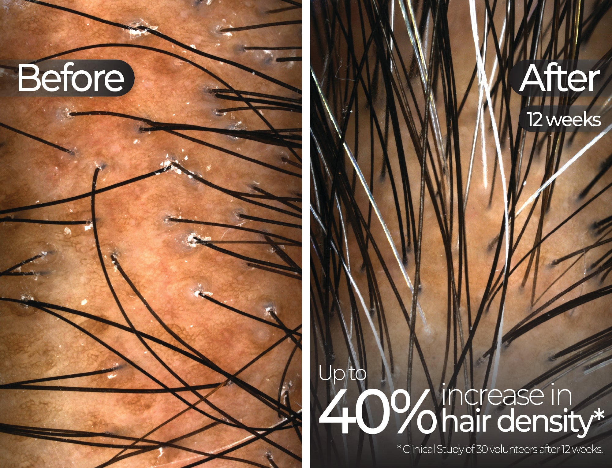 Before & After slide 2