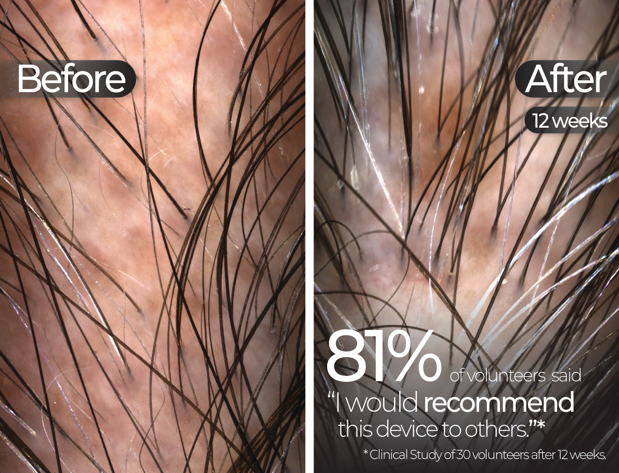 Before & After slide 5