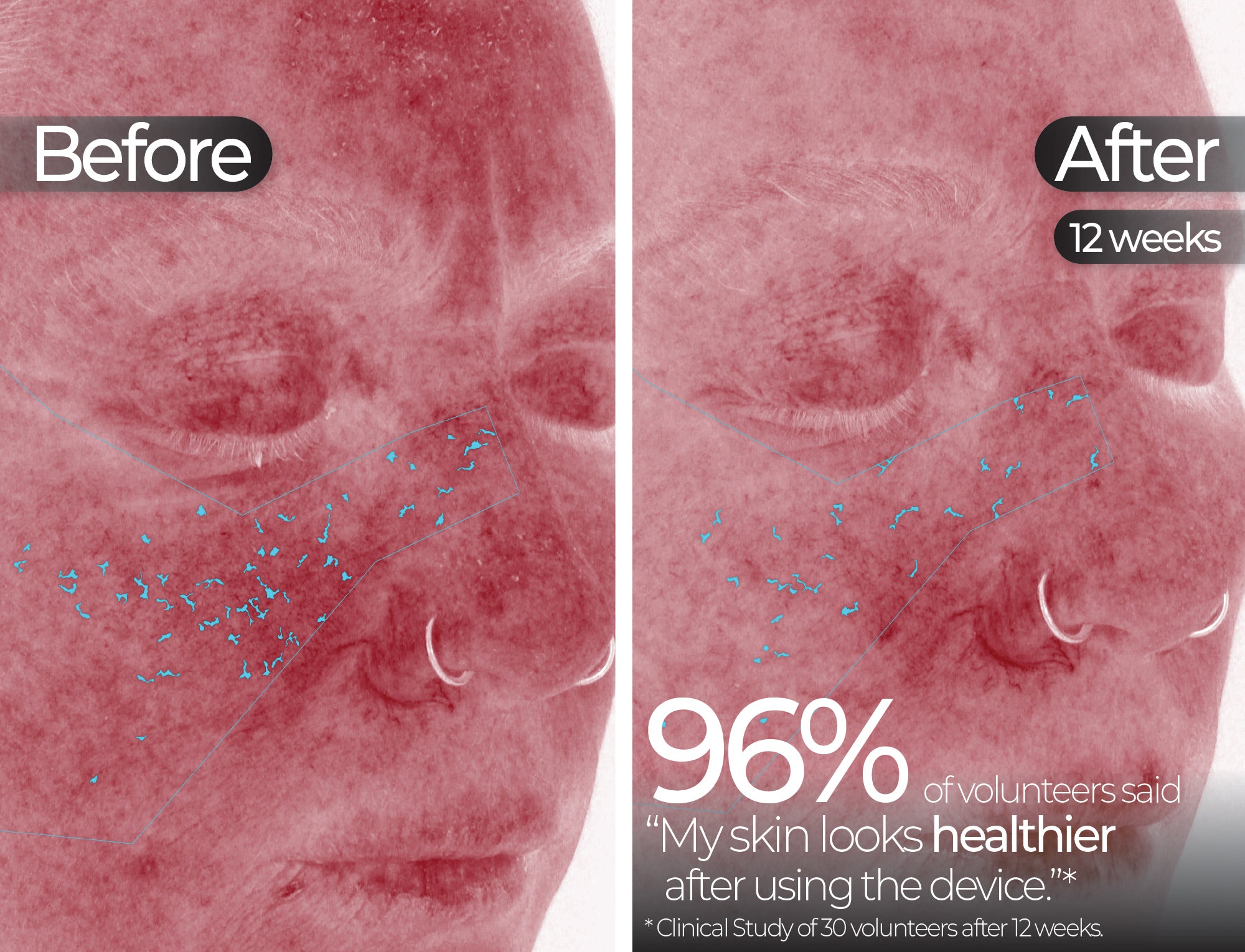 Before & After slide 5