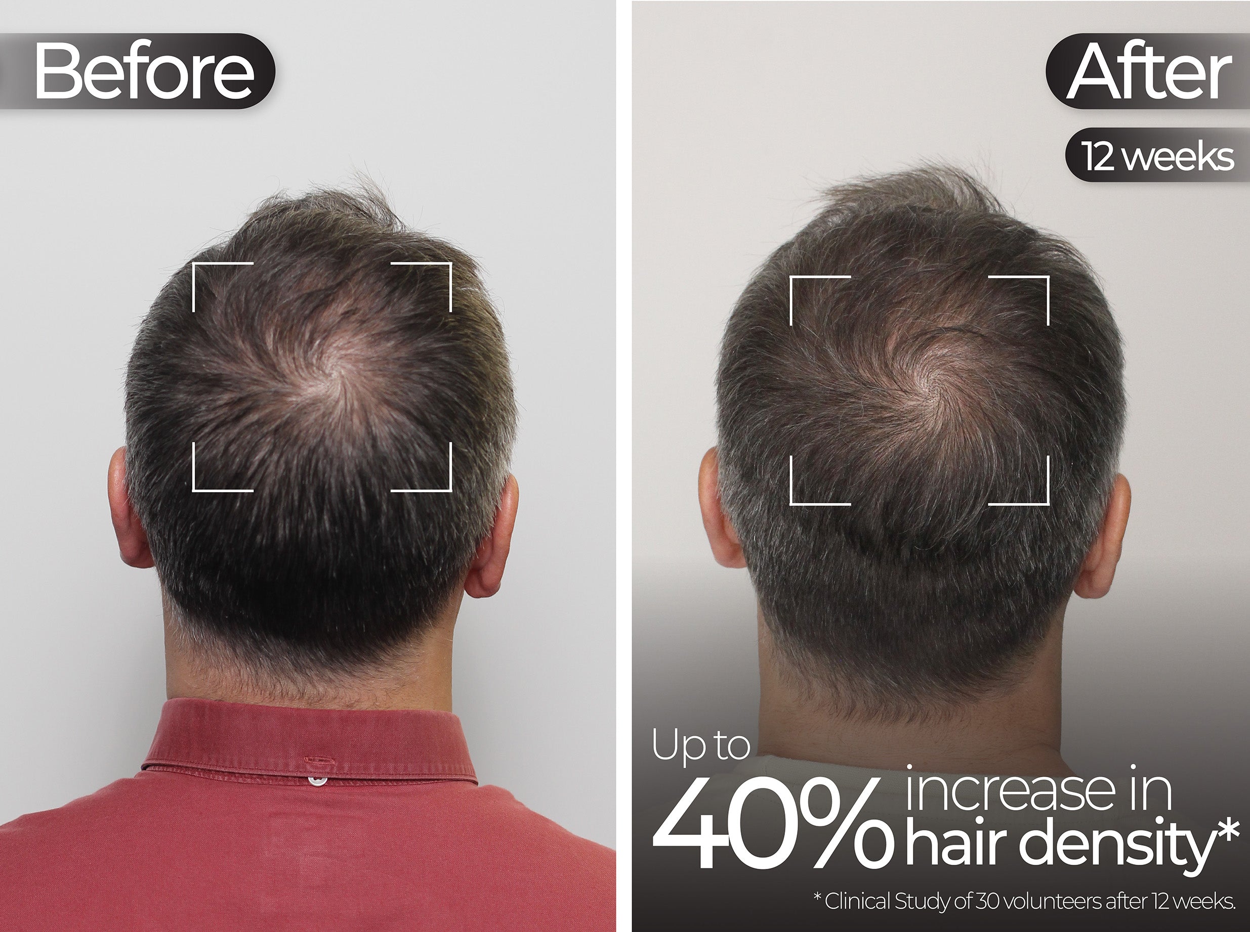 Before & After slide 3