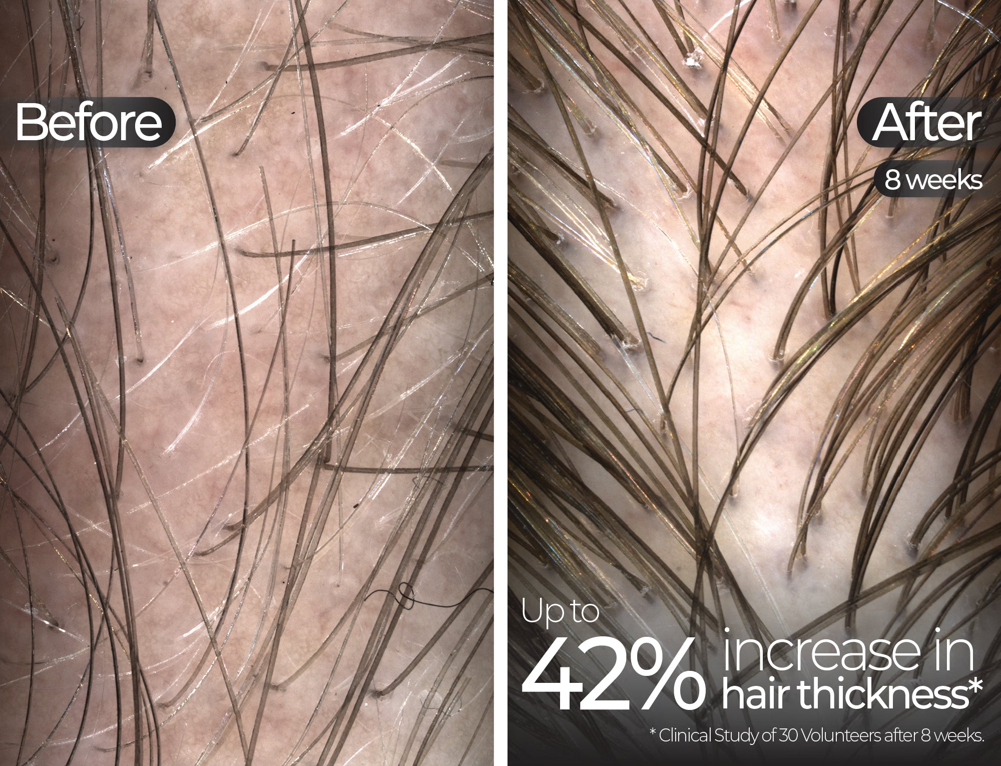 Before & After slide 2