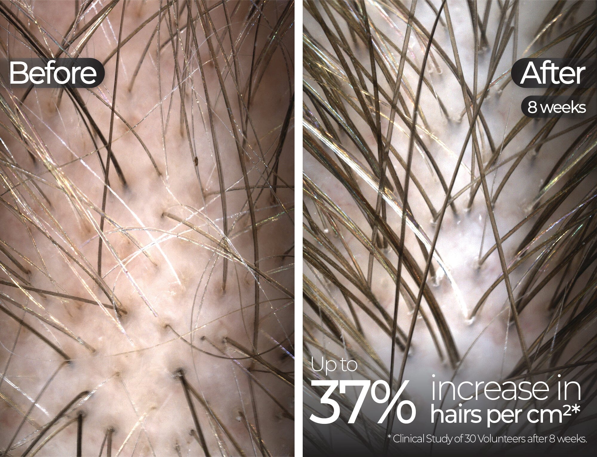 Before & After slide 4