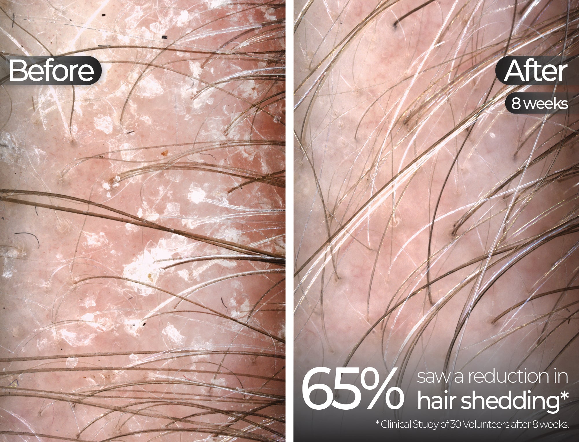 Before & After slide 5